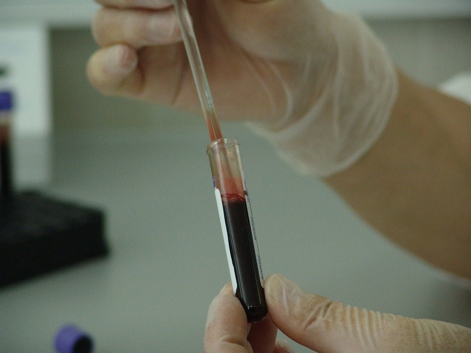 Общий анализ крови в Пензенской районной больнице